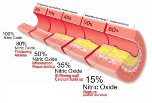 Change in structure of blood vessel with loss of nitric oxide