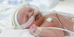 Baby receiving inhaled nitric oxide gas at 30-40 ppb in order to treat his/her pulmonary hypertension