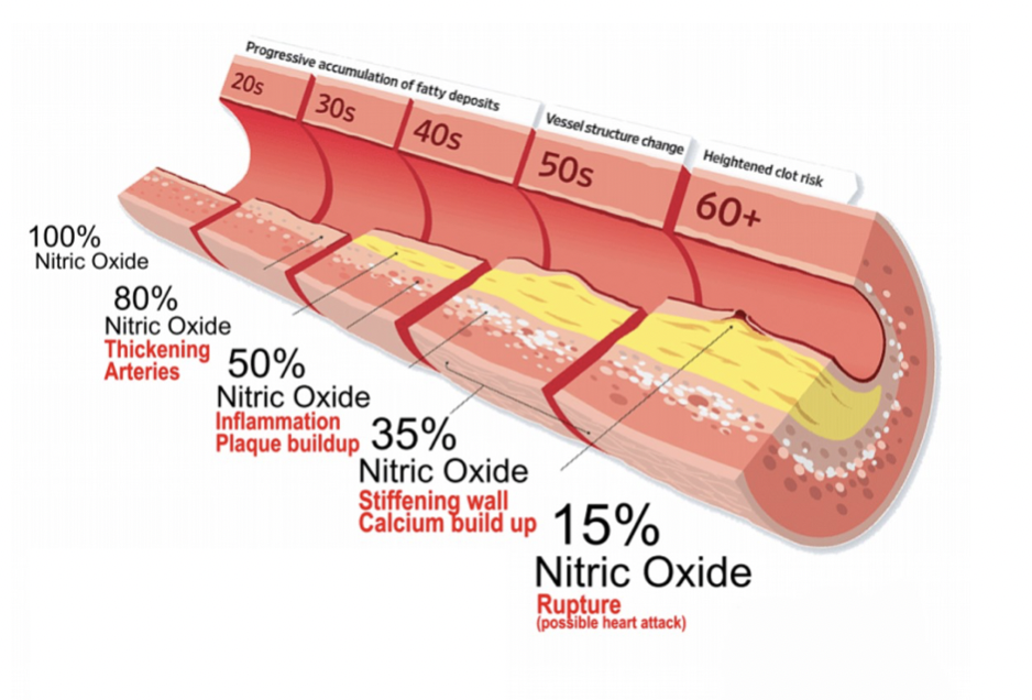 NITRIC OXIDE: THE END OF CARDIOVASCULAR DISEASE